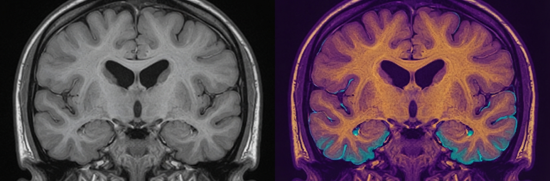 AEGIS P22 false-colour brain MRI — tissue segmentation with vivid class palettes