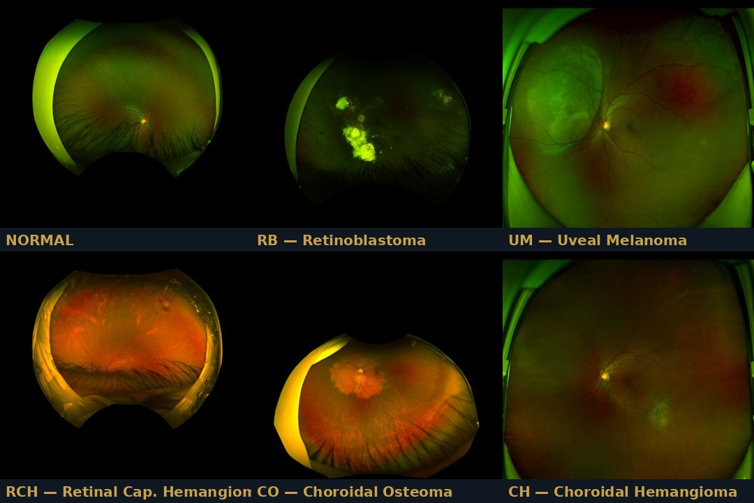 AEGIS P25T — fundus image grid showing six intraocular disease classes